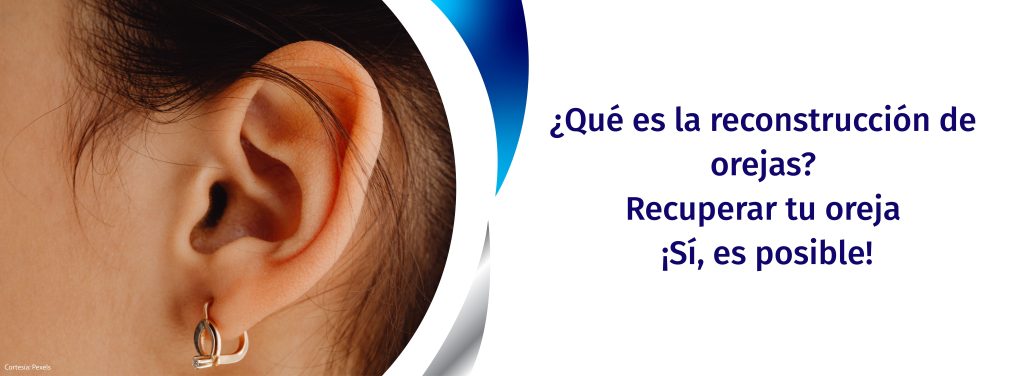 reconstruir oreja